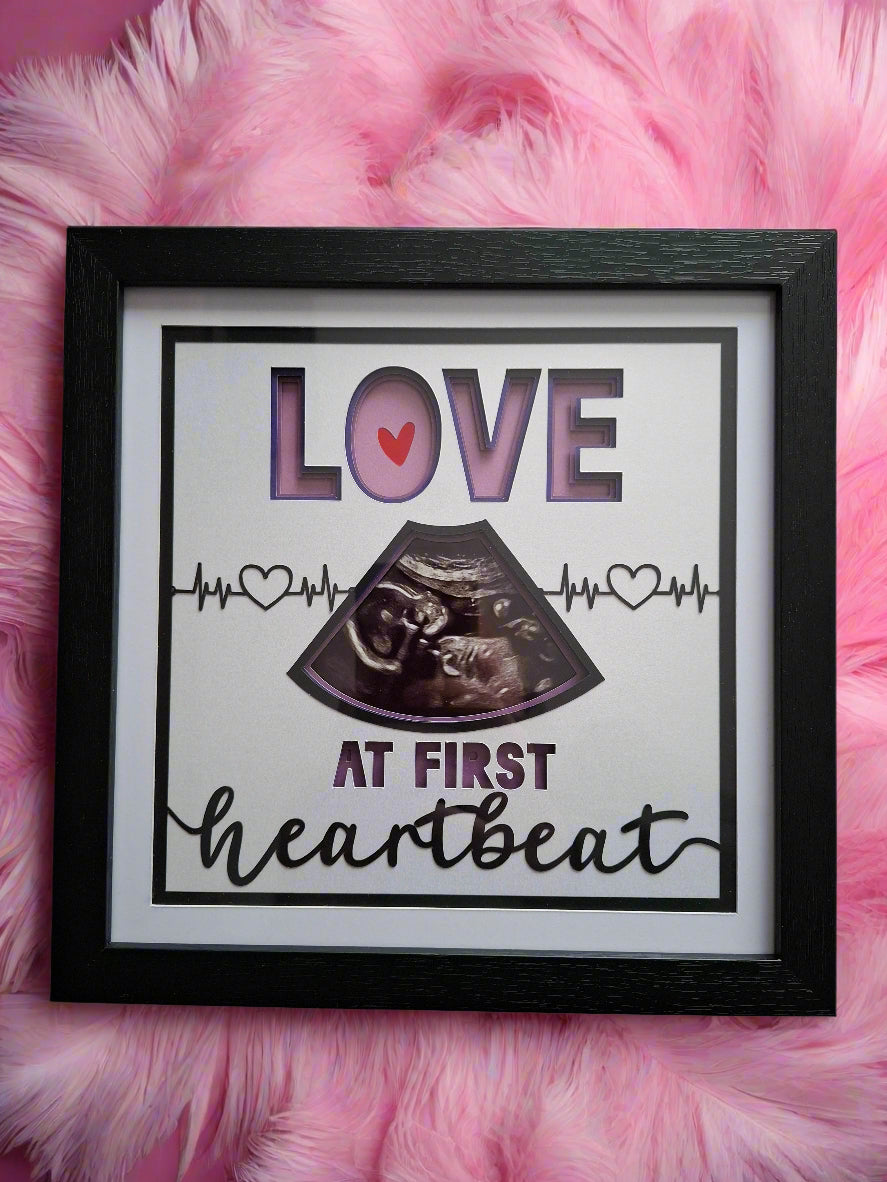 Ultrasound Baby Art