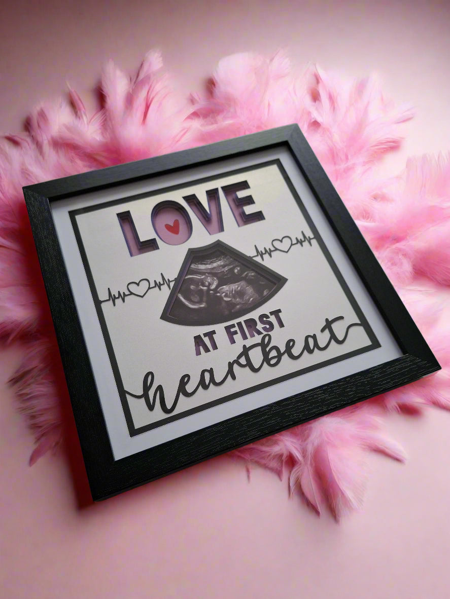 Ultrasound Baby Art