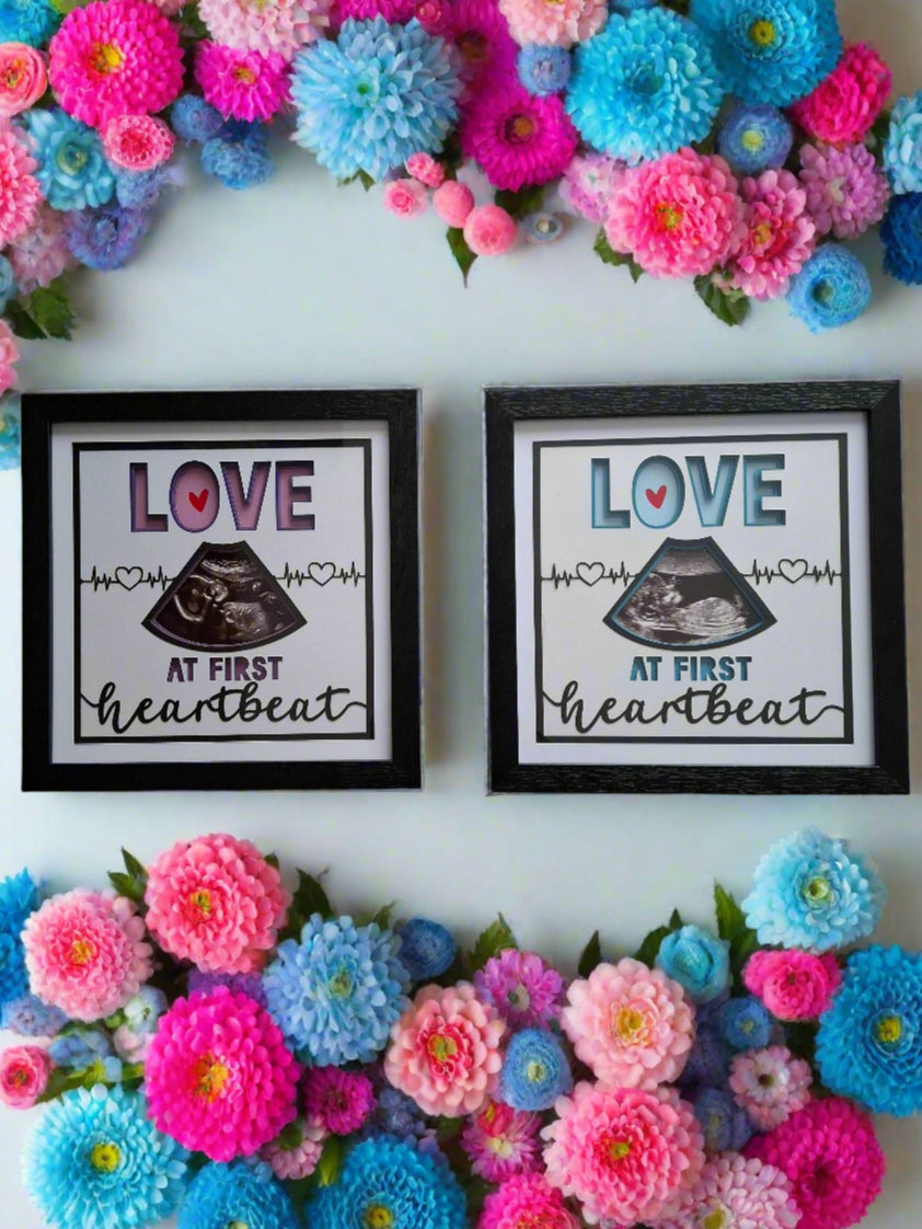 Ultrasound Baby Art